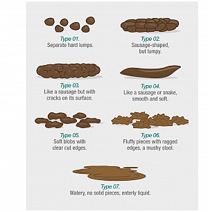 Câu hỏi thường gặp – Xét nghiệm Calprotectin