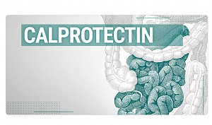 Calprotectin là gì?