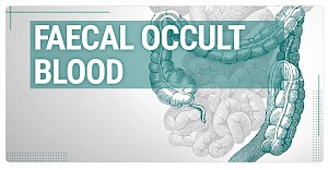 FOB - Máu ẩn trong phân là gì?