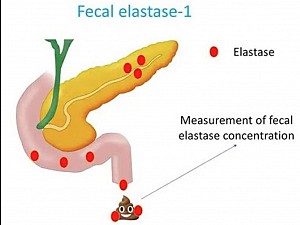 Câu hỏi thường gặp – Xét nghiệm Pancreatic Elastase