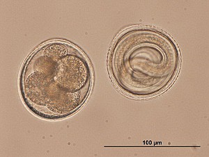 Toxocariasis là gì?