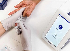 Xét nghiệm HbA1c bằng phương pháp POC (Point-of-Care): Thuận lợi và khó khăn