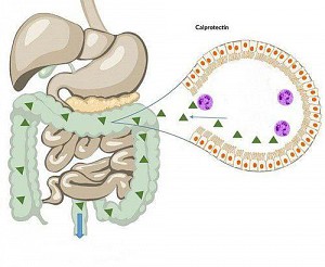 Tại sao cần kiểm tra calprotectin trong phân?