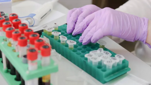 Cách chuẩn bị mẫu cho ELISA