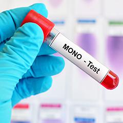 Monotest – Xu hướng mới trong lĩnh vực xét nghiệm miễn dịch?