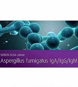 Aspergillus fumigatus IgG