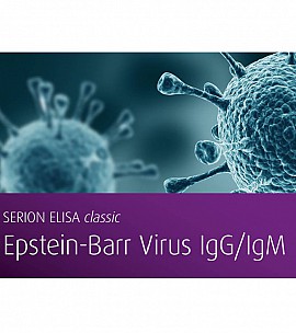 Epstein Barr Virus VCA IgM