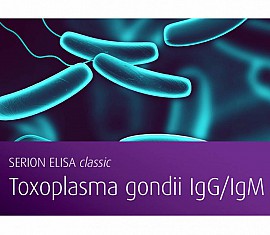 Toxoplasma gondii IgG