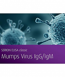 Mumps Virus IgM